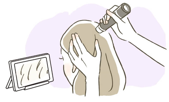 頭皮検査(初回と状態に応じて検査)